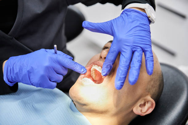 Best Emergency Tooth Extraction in White Oak, OH